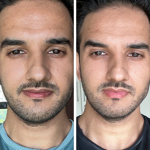 Mens Combo Kit - Face Wash, Face Scrub & lipcare (100ML)